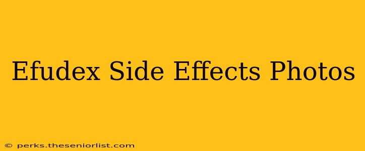 Efudex Side Effects Photos