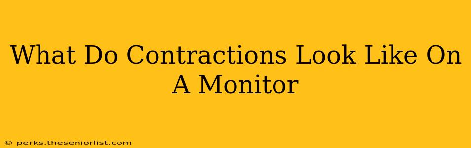 What Do Contractions Look Like On A Monitor